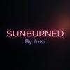 undefined Sunburned By Love