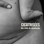 Podcast Cicatrisées