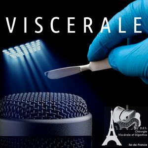 Viscerale